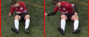 ¡Qué dolor! Futbolista se dislocó la rodilla y se la “acomodó” a puños