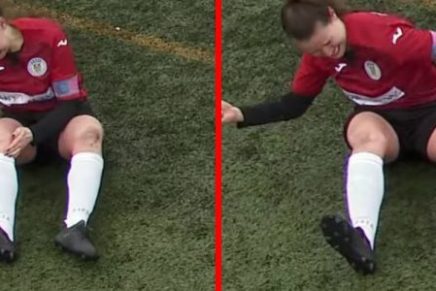 ¡Qué dolor! Futbolista se dislocó la rodilla y se la “acomodó” a puños