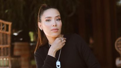 Fotografías dejaron en evidencia el impresionante cambio físico de Luisa Fernanda W luego de sus cirugías