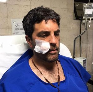 Actor de 'Enfermeras' recibió disparo en la cara durante robo en Bogotá