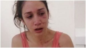 Mujer agredida por un sujeto en Quindío _ Foto_ Instagram Laura Santa