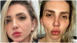 Mujer se arrepiente de hacerse cirugía en el rostro _ Foto_ Instagram