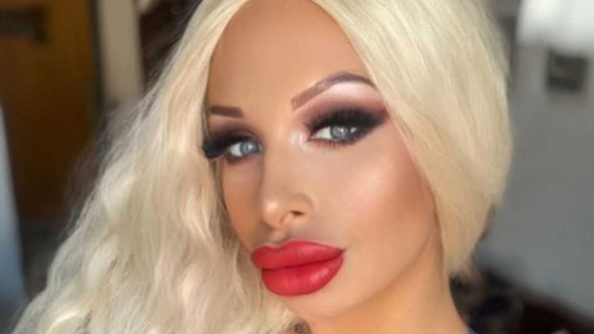 A actriz de ‘nopor’ se le reventó un implante y lo reemplazó con una bolsa de harina