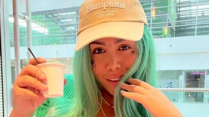 “Se lo advertí muchas veces”: cirujano de las barbies sobre operación de Yina Calderón