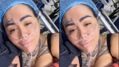 Yina Calderón cirugía