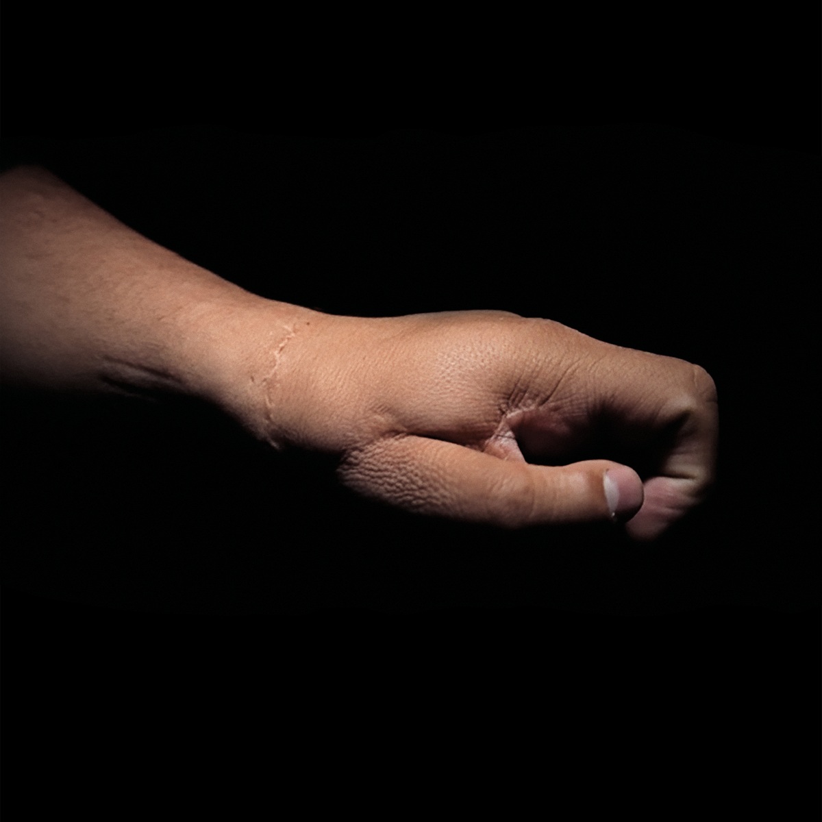 Disminuyó en un 42,3% los casos de quemados con pólvora en Bogotá: cifras completas 2025